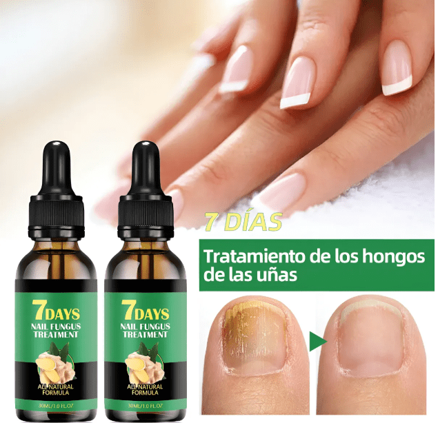 Gotas para Hongos Fungus – ECOM-0007