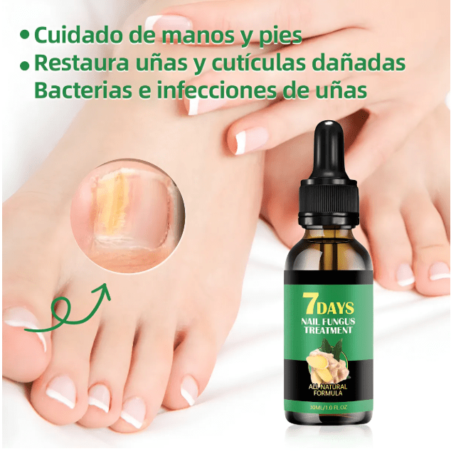 Gotas para Hongos Fungus – ECOM-0007