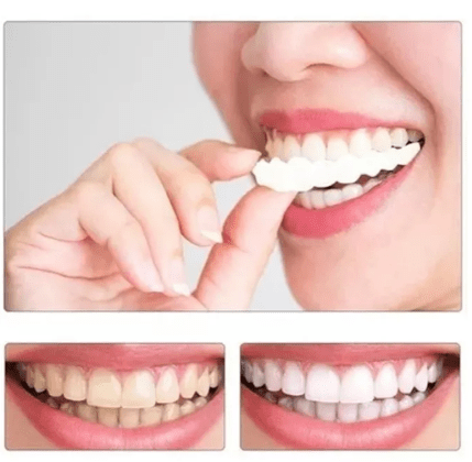 CARILLAS DENTALES