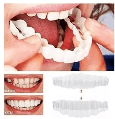 CARILLAS DENTALES