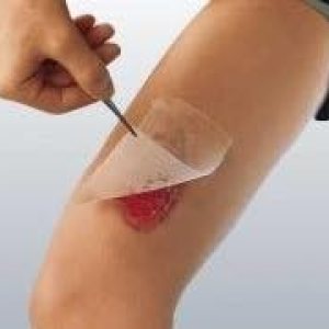 Aderezo de gasa Cuticerin Smith and Nephew – 4 X 4 pulgadas Aderezo de gasa Cuticerin Smith and Nephew – 4 X 4 pulgadas