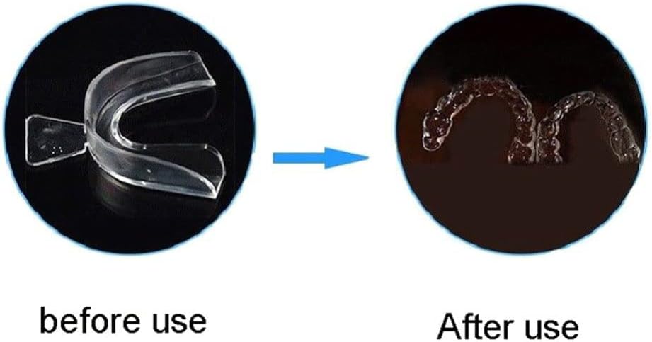 Magik Paquete de 8-16 protectores bucales de silicona para apretar los dientes, molienda dental moldeable (16 unidades, blanco+verde+rosa)