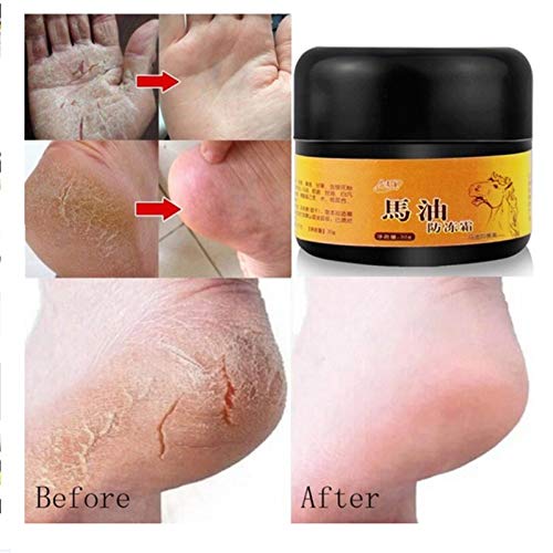 Crema hidratante reparadora de piel con aceite de caballo para pies agrietados y secos ásperos (como se muestra)