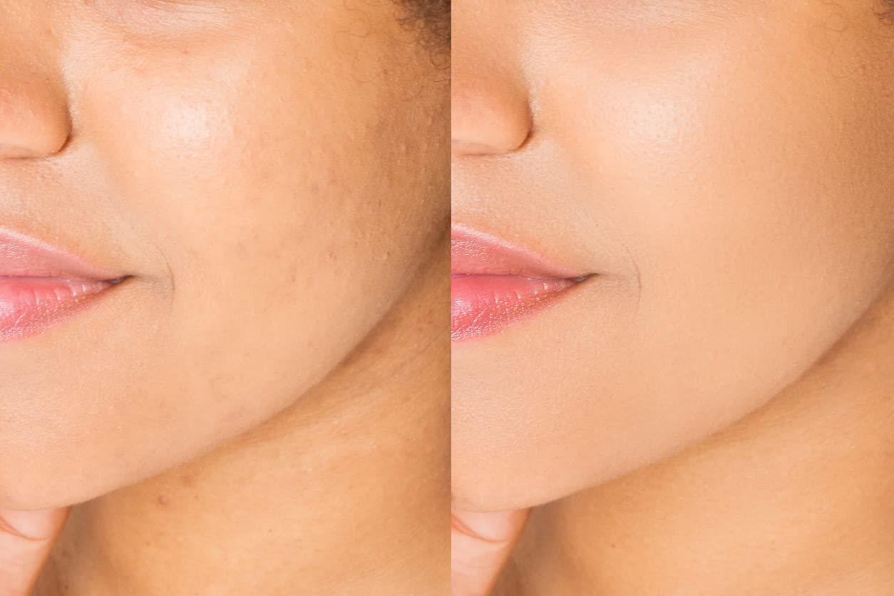 Limpiador Refinador Facial Espumoso Exfoliante Yuca