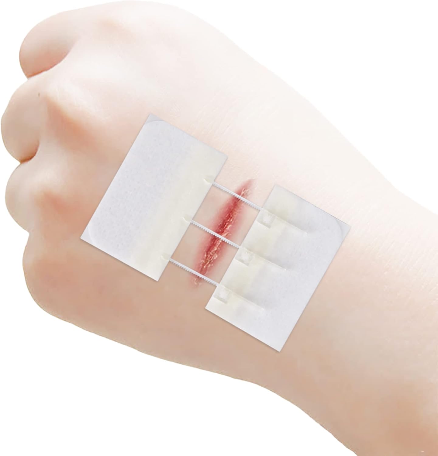 Cierres de heridas de emergencia, vendajes adhesivos para cortes y heridas sin puntadas, imprescindibles para kit de primeros auxilios, kit de