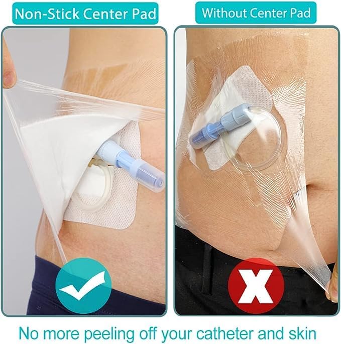 Vendajes de incisión impermeables posquirúrgicos para vendaje de heridas grandes, parche adhesivo transparente para diálisis PICC, puerto de pecho,