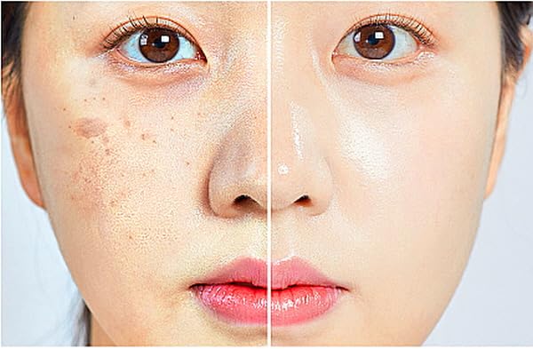 WHITESILK T1(SS) COLLAGEN 100 INSTANT Reverse Lift Facial Toning Peel Off Mascarilla facial para una piel más firme, húmeda y brillante con colágeno