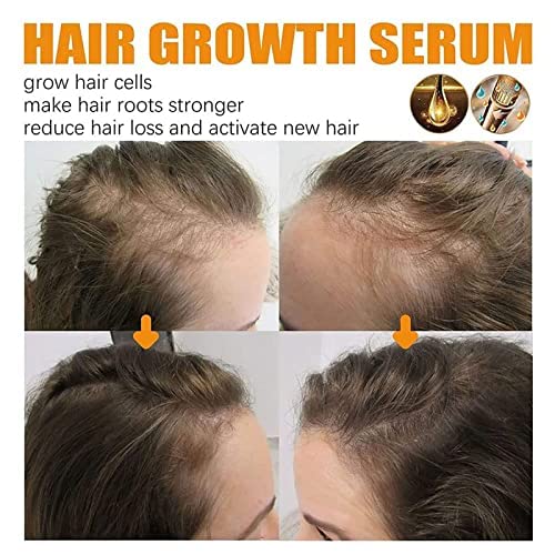 Suero para el crecimiento del cabello para mujeres negras, suero de belleza para el cabello, suero de crecimiento del cabello para mujeres negras (3