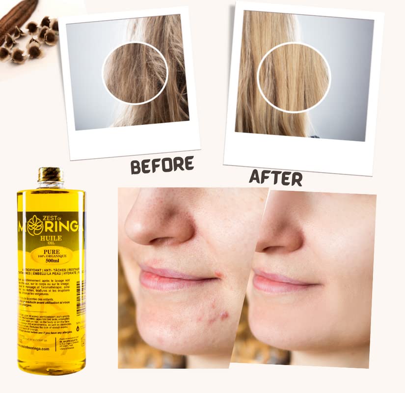 Zest Of Moringa Aceite facial para arrugas antienvejecimiento  Aceite de moringa para el cuidado de la piel, cuidado del cabello, tratamiento del