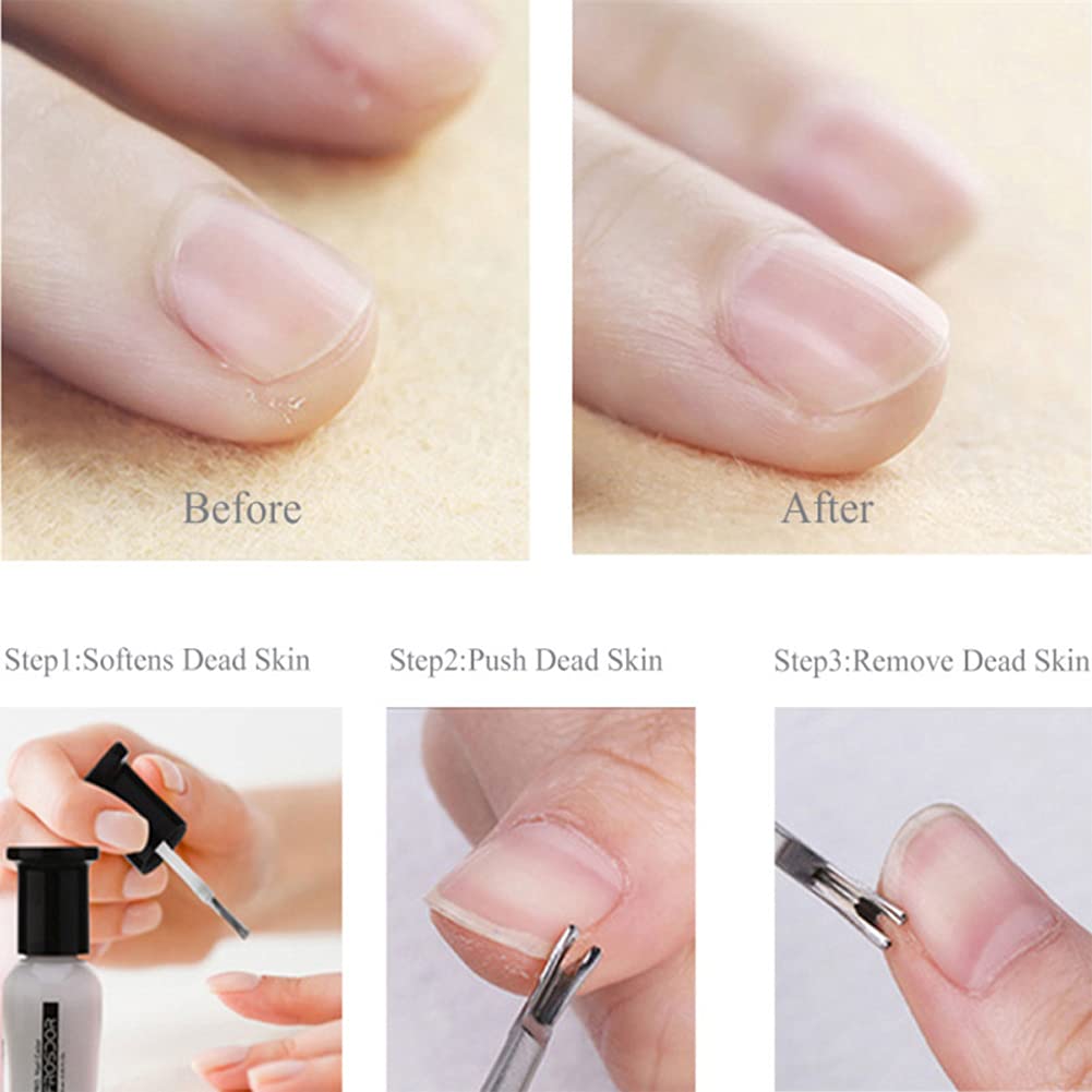 Empujador de cutículas de uñas inoxidables, cortador de tijeras, removedor de tijeras, limpiador de uñas de piel muerta, eliminación de callos de