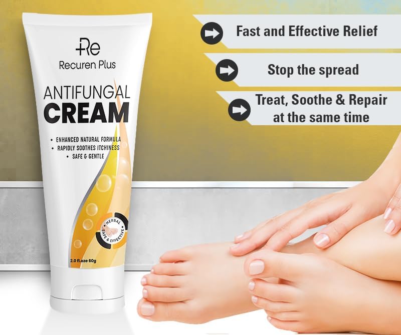 Crema antifúngica Tratamiento de pies de atletas – Tratamiento Versicolor de tiña – Crema de comezón jock – Tratamiento de pies de atletas extra