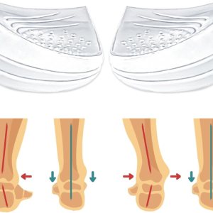 Skyfoot Insertos de cuña de talón ajustables de 3 capas para corrección de supinación y pronación, plantillas adhesivas de talón medial y lateral Skyfoot Insertos de cuña de talón ajustables de 3 capas para corrección de supinación y pronación, plantillas adhesivas de talón medial y lateral