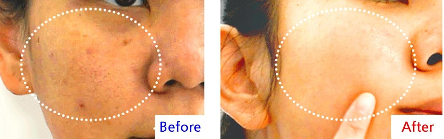 WHITESILK T1(SS) COLLAGEN 100 INSTANT Reverse Lift Facial Toning Peel Off Mascarilla facial para una piel más firme, húmeda y brillante con colágeno