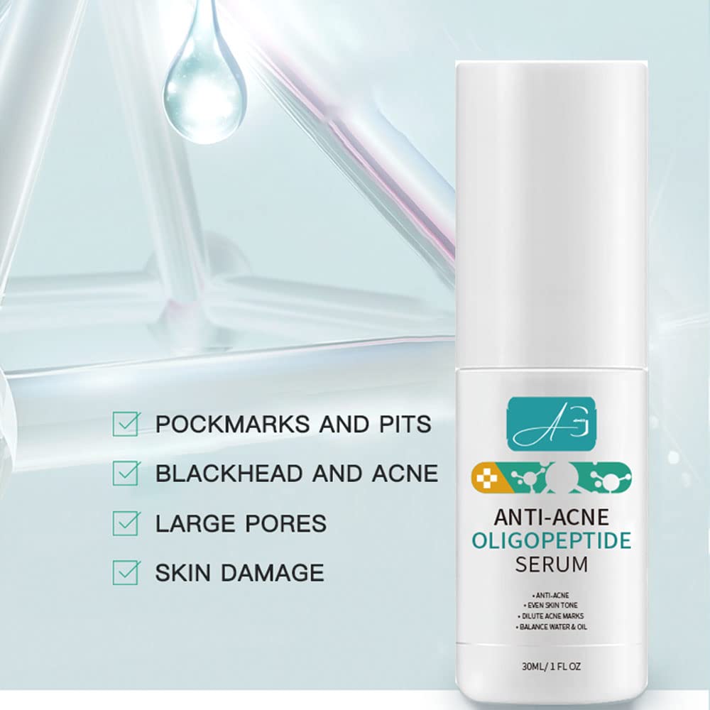 Suero de oligopéptido anti-acné para reparación de barrera de piel de cuidado facial. Tratamiento para aclarar marcas y hoyos, estimulando la