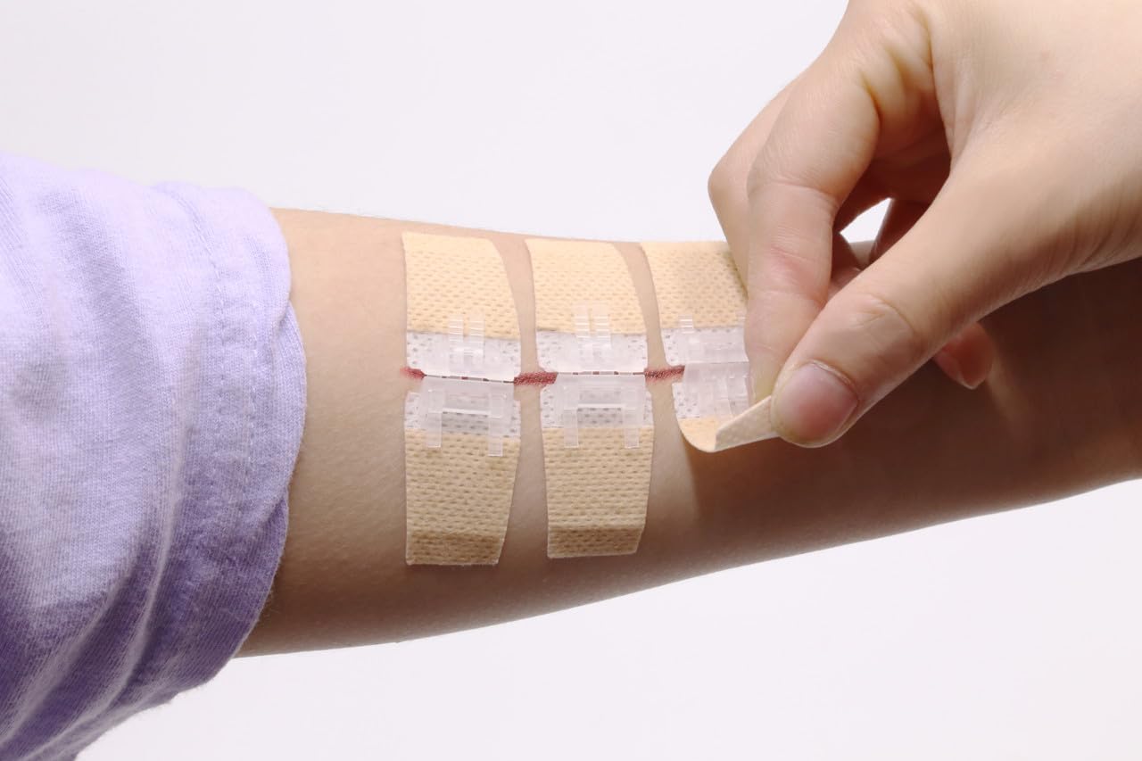 Dispositivo de cierre de heridas por laceración, tiras de cierre de laceración de emergencia para reparar – Paquete de 10 unidades
