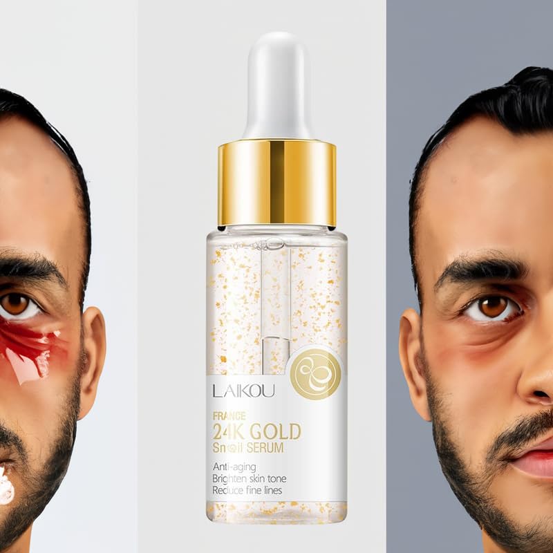 EKHAYA – Suero reparador de mucina de caracol suero hidratante de esencia de mucina de caracol con vitamina C para rejuvenecimiento de la piel,