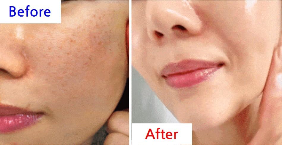 WHITESILK T1(SS) COLLAGEN 100 INSTANT Reverse Lift Facial Toning Peel Off Mascarilla facial para una piel más firme, húmeda y brillante con colágeno