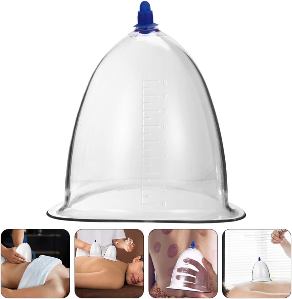 Dispositivo de terapia de ventosas al vacío de presión negativa, conjunto de ventosas al vacío, conjunto de ventosas para el cuerpo, cuerpo de