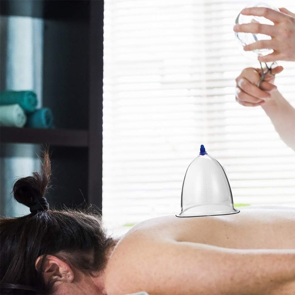 Dispositivo de terapia de ventosas al vacío de presión negativa, conjunto de ventosas al vacío, conjunto de ventosas para el cuerpo, cuerpo de