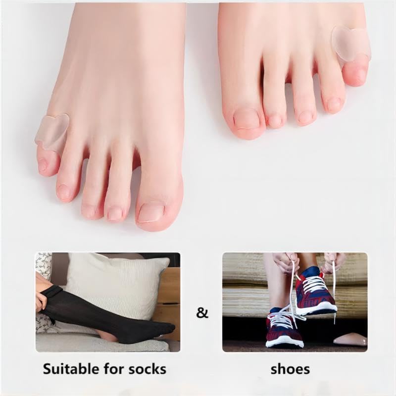 Carolhome – 10 separadores de gel para dedos de dedo meñique, de un solo bucle, esparcidor de dedo pequeño para juanetes, corrector superposición de