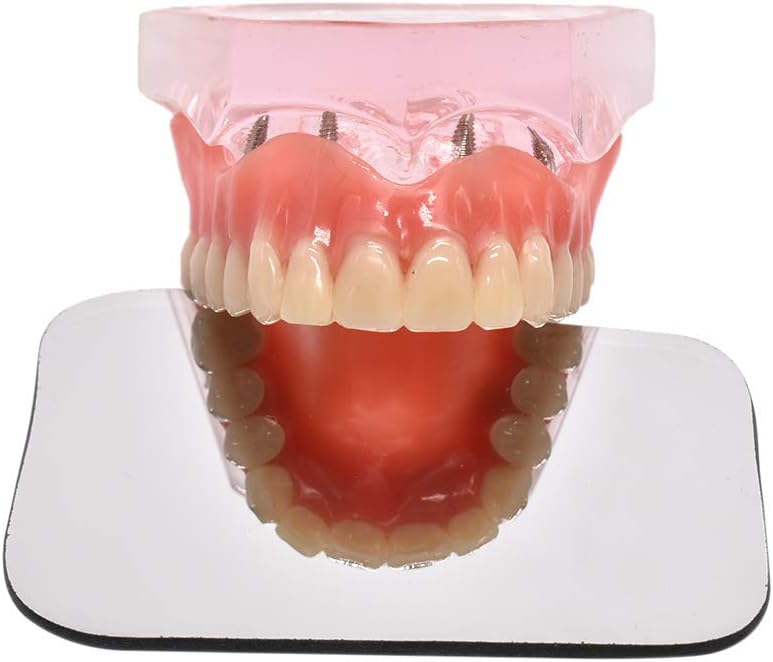 Espejo oral Dental Reflector de dos caras Fotográfico Titanio Espejo intraoral de vidrio (5 unidades)