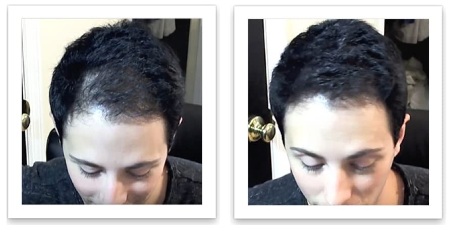 Oculta puntos calvos y bordes calvos al instante. Haz que el cabello fino se vea 10 veces más lleno. Kit de inicio de fibra capilar Caboki (negro)