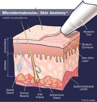 NeedCrystals Cristales de microdermoabrasión para máquinas, paquete de 2, tratamiento exfoliante facial totalmente natural para piel opaca o seca,