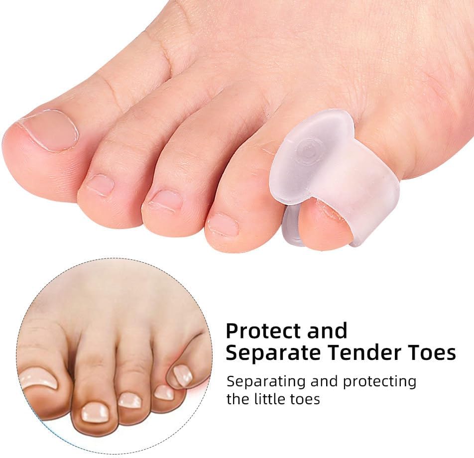 Carolhome – 10 separadores de gel para dedos de dedo meñique, de un solo bucle, esparcidor de dedo pequeño para juanetes, corrector superposición de