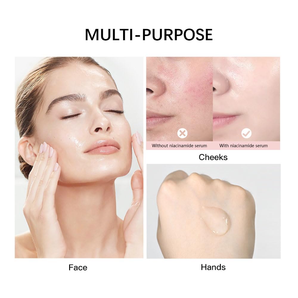 Suero facial de niacinamida para cara y piel, suero facial hidratante para acné, manchas oscuras, poros, líneas finas