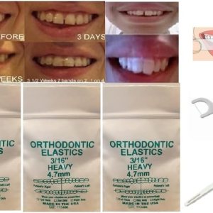 Bandas dentales de ortodoncia con tiras blanqueadoras, hilo dental y cepillo de dientes envuelto Bandas dentales de ortodoncia con tiras blanqueadoras, hilo dental y cepillo de dientes envuelto