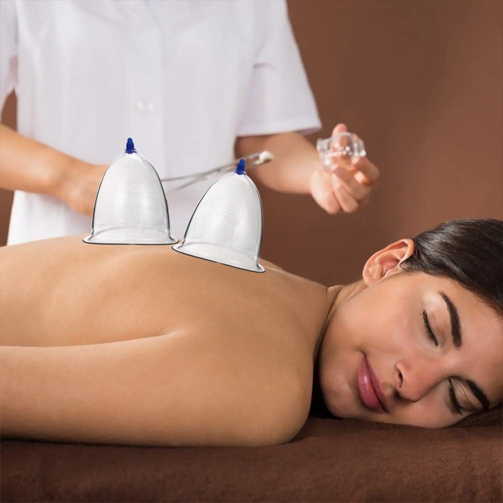 Dispositivo de terapia de ventosas al vacío de presión negativa, conjunto de ventosas al vacío, conjunto de ventosas para el cuerpo, cuerpo de