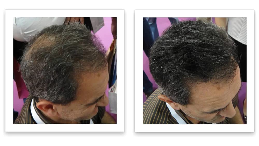 Tamaño de prueba elimina el punto calvo y el adelgazamiento del cabello al instante. Haz que el cabello fino se vea 10 veces más lleno. Fibra