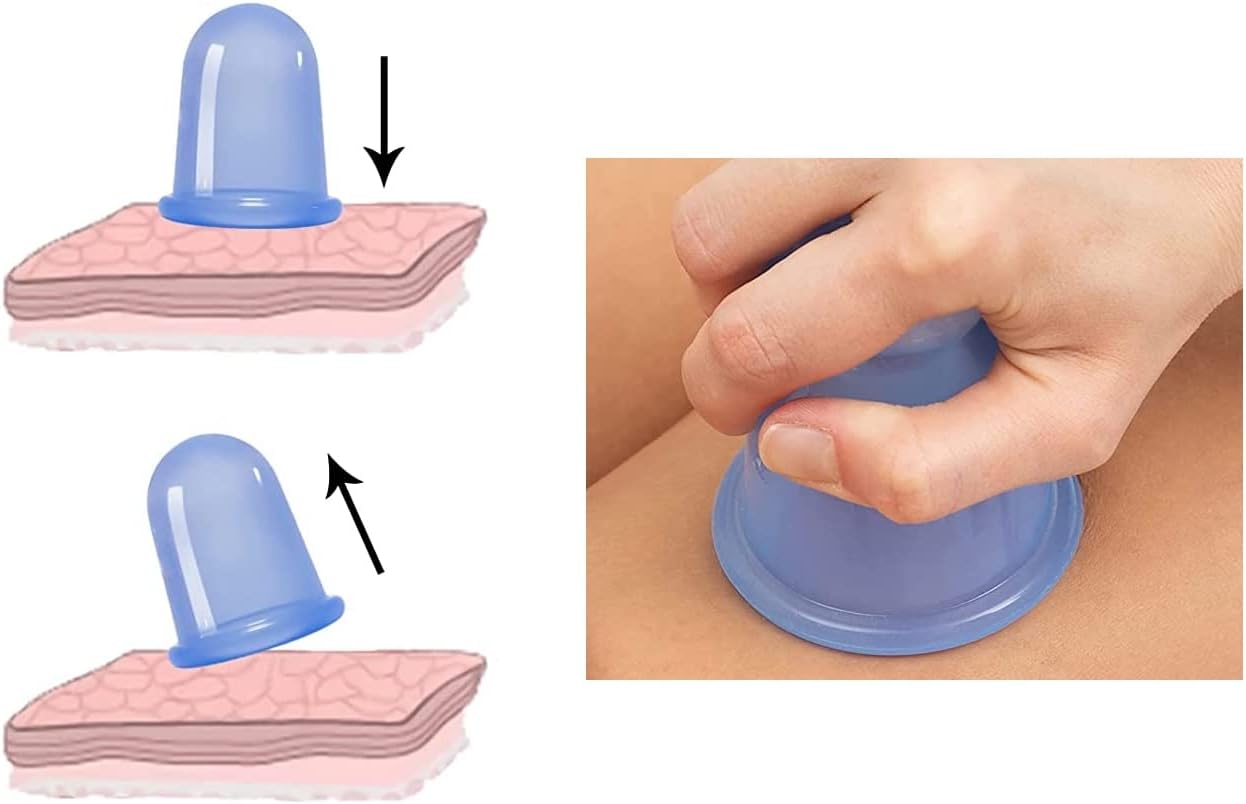 YF STORE Juego de terapia de ventosas  Tazas médicas de terapia de masaje de silicona para reducción de celulitis y relajación muscular, 4 tamaños