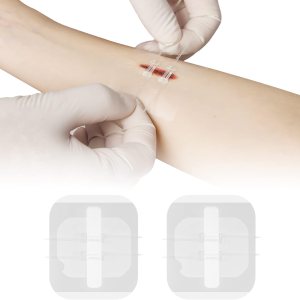 Reparación de laceración de puntada con cremallera sin puntadas, vendas de mariposa, coágulo rápido, dispositivo de cierre de heridas de emergencia, Reparación de laceración de puntada con cremallera sin puntadas, vendas de mariposa, coágulo rápido, dispositivo de cierre de heridas de emergencia,