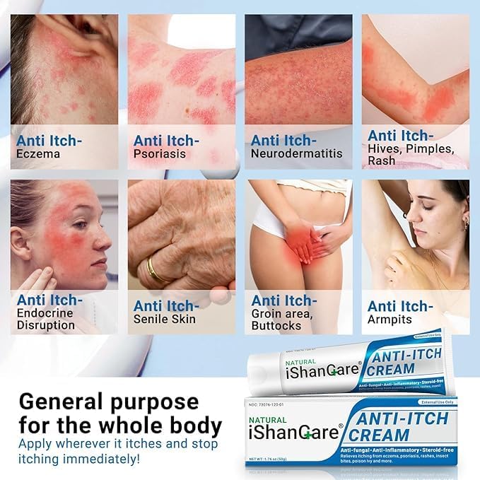 Crema calmante antipicazón extra fuerte ungüento para aliviar la picazón de la piel, para picazón de cuerpo completo causado por cambios
