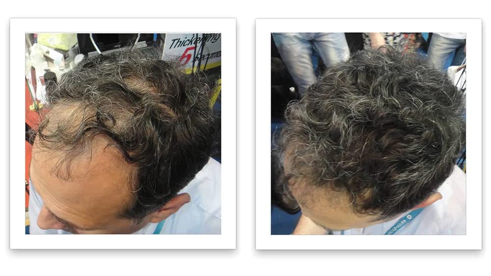 Tamaño de prueba elimina el punto calvo y el adelgazamiento del cabello al instante. Haz que el cabello fino se vea 10 veces más lleno. Fibra
