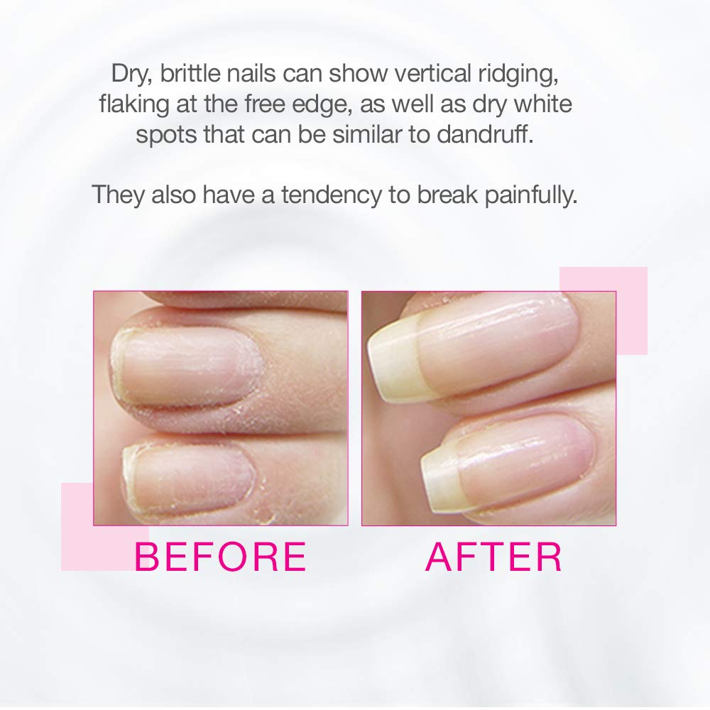 Nail Tek Protection Plus 3, fortalecedor de uñas para uñas duras y quebradizas, 0.5 onzas, paquete económico de 4 unidades