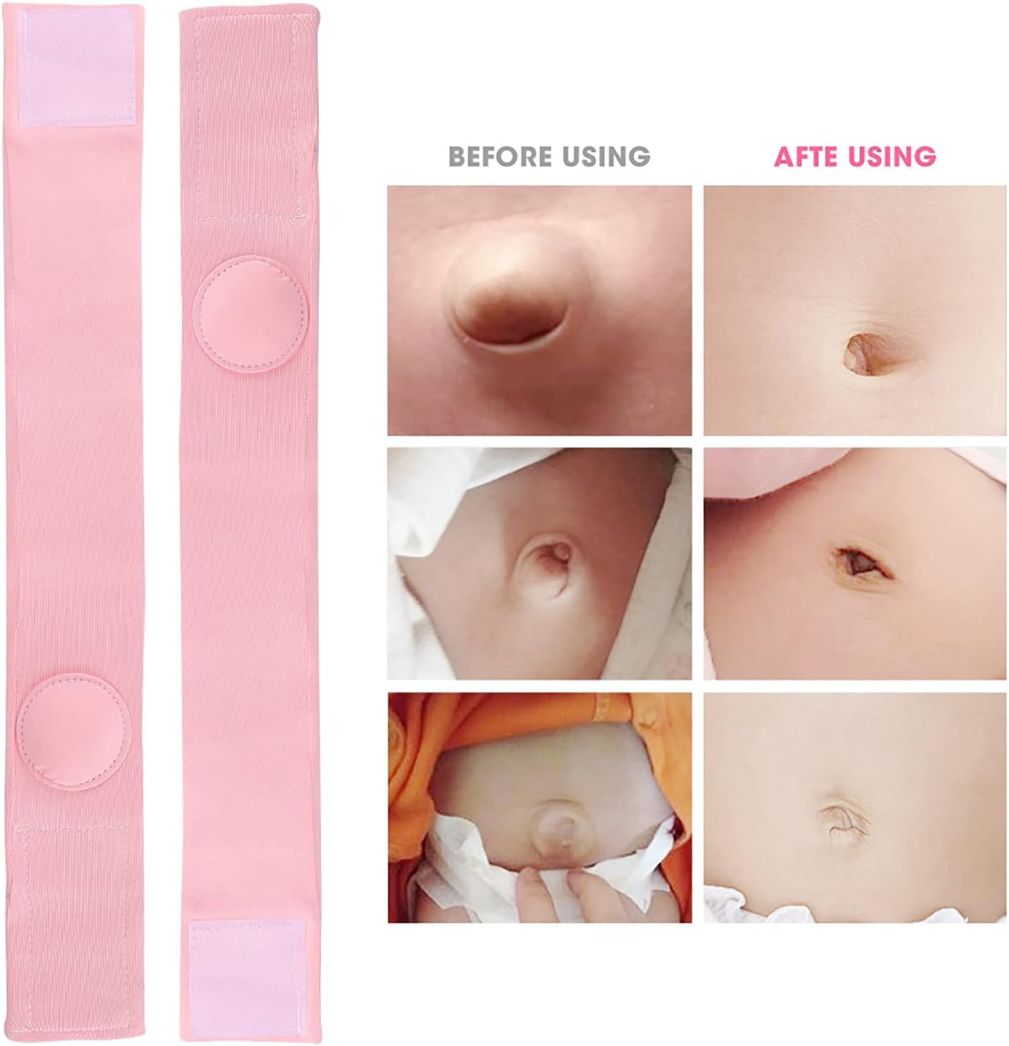 Cinturón de hernia umbilical para bebé, 2 piezas, cinturón de hernia, tratamiento de hernia, cinturón de hernia umbilical para bebés (rosa)