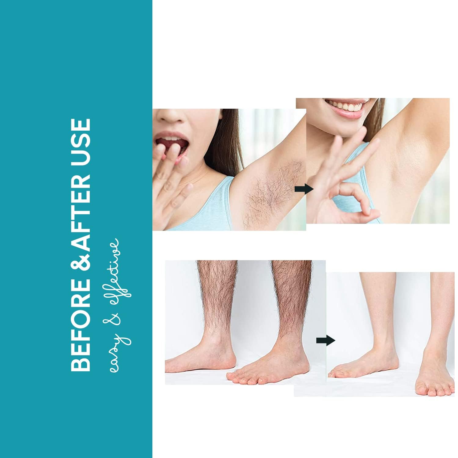 Crema depilatoria – Depilación rápida e indolora para una piel suave, dermatólogamente probada para áreas sensibles, crema depiladora para mujeres