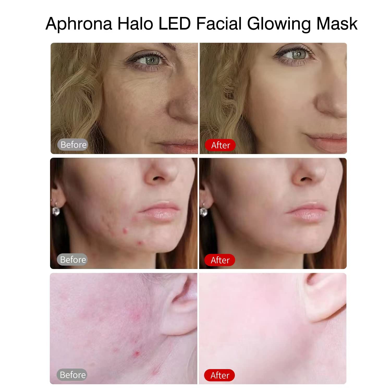 Aphrona Halo Led Light Therapy Face LED Light Therapy Skin Care Máscara de fotón, luz azul y roja para tratamiento del acné, eliminación de arrugas
