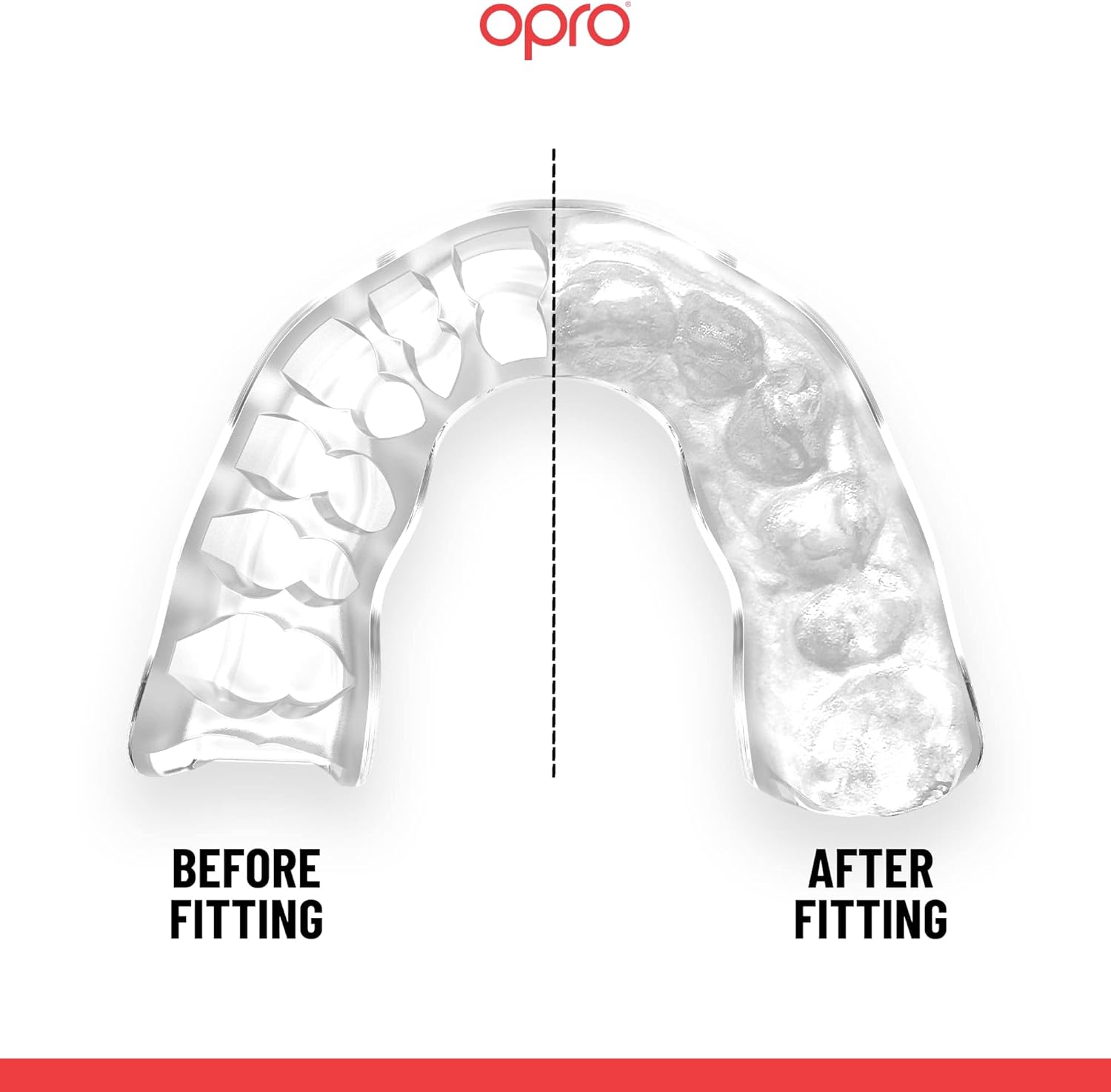 OPRO Protector bucal deportivo instantáneo a medida, protector bucal para dentista, revolucionaria tecnología de ajuste para máxima comodidad,