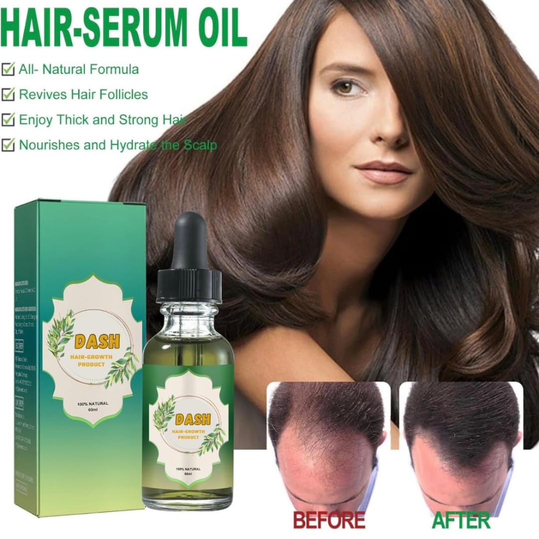 Dash Aceite de crecimiento del cabello, aceite de romero avanzado para el crecimiento del cabello, mezcla única de aceite capilar para cabello seco