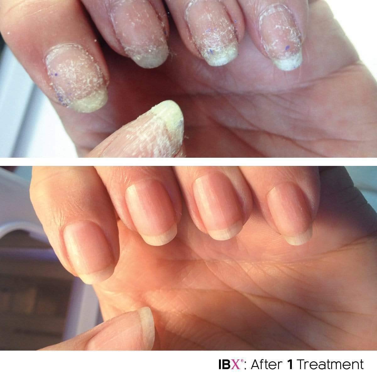 NUEVO! IBX Mini Duo Pack Con Aceite Dadi GRATIS Restauración Protección Uñas