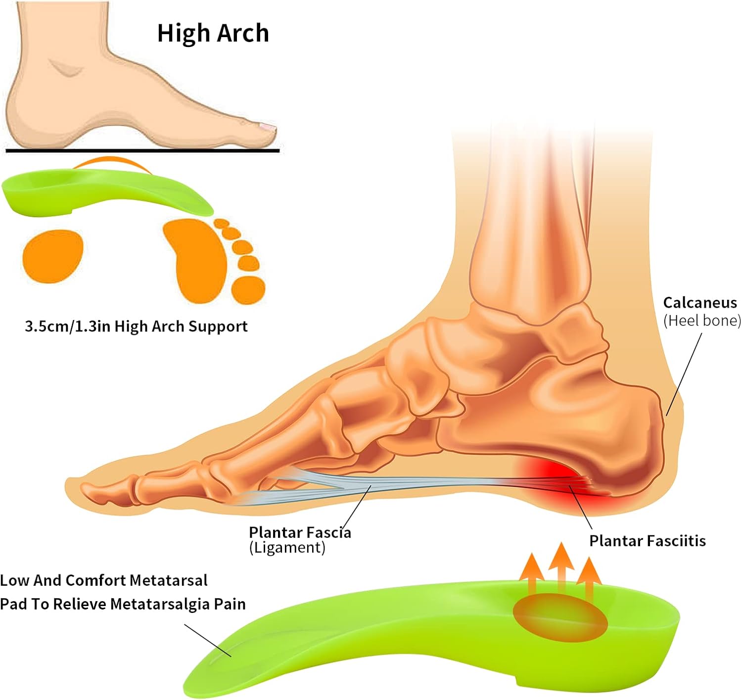 Almohadilla metatarsiana original de arco alto 34 para aliviar la pronación del pie, espalda, cadera, pierna y rodilla, espolones para el dolor para