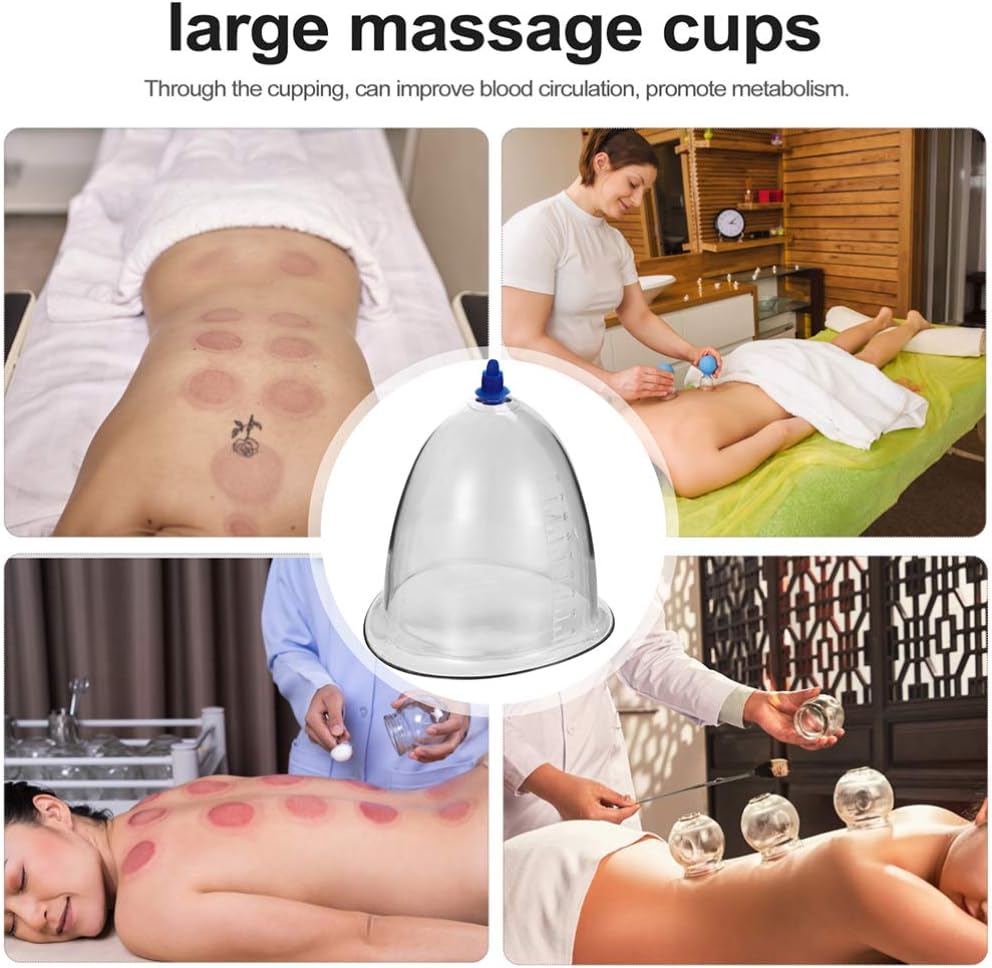 Dispositivo de terapia de ventosas al vacío de presión negativa, conjunto de ventosas al vacío, conjunto de ventosas para el cuerpo, cuerpo de