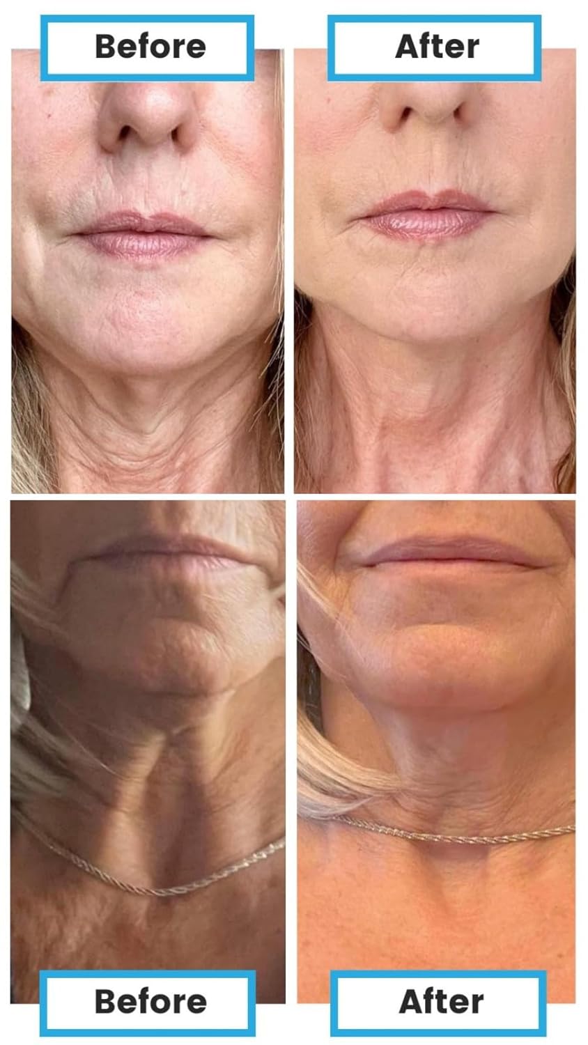 Spray facial de 3.4 onzas líquidas (nano-formulado) con glutatión, colágeno y ácido hialurónico, cuidado facial y firme, espray facial minimizador
