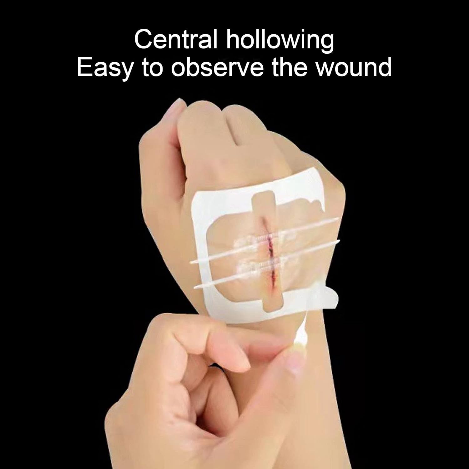 Cremalleras de cierre de heridas de emergencia, 4 suturas de puntada con cremallera, bandaids para reparar heridas sin puntadas, dispositivo de