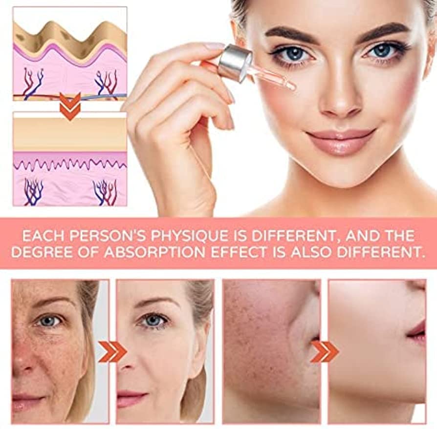 Suero facial 5 en 1, reduce las arrugas, suero corrector de manchas oscuras, suero facial con ácido hialurónico y niacinamida (2 unidades)