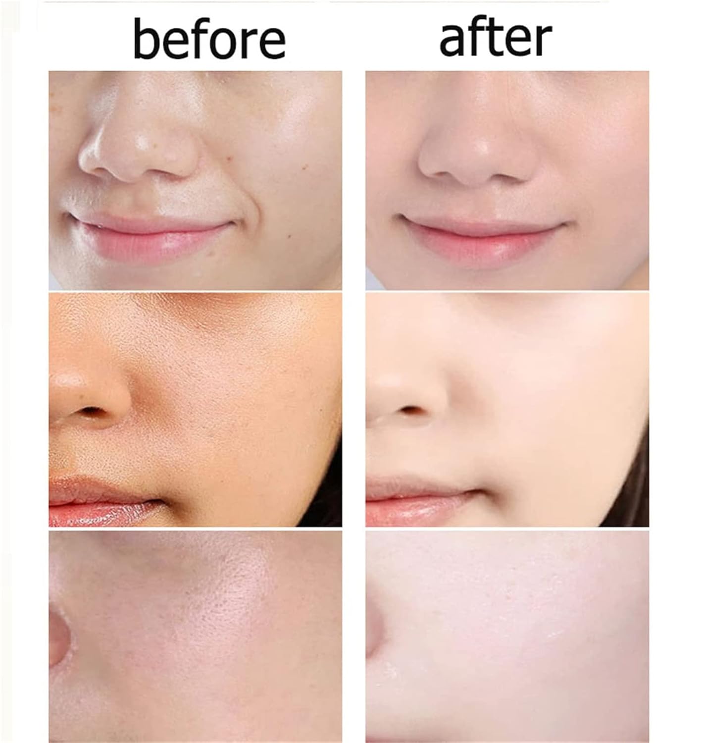 znvwki Hilos Tensores Para El Rostro, Hilos de Colageno Absorbibles para la Cara, Acido Hialuronico Puro Para Rostro, Hilo Proteína Soluble Coreana