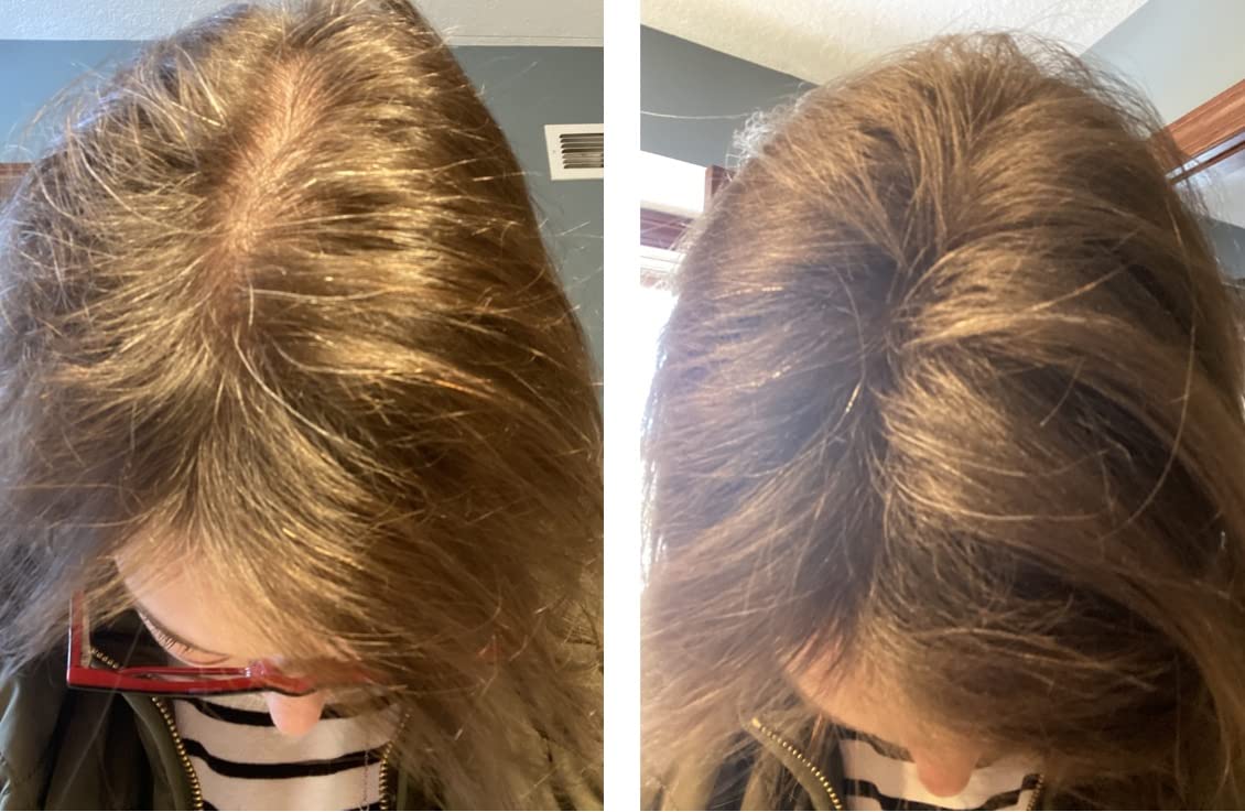 Cubre las manchas calvas y el cabello fino al instante. Obtén un cabello 10 veces más lleno con fibra natural para construir el cabello a base de